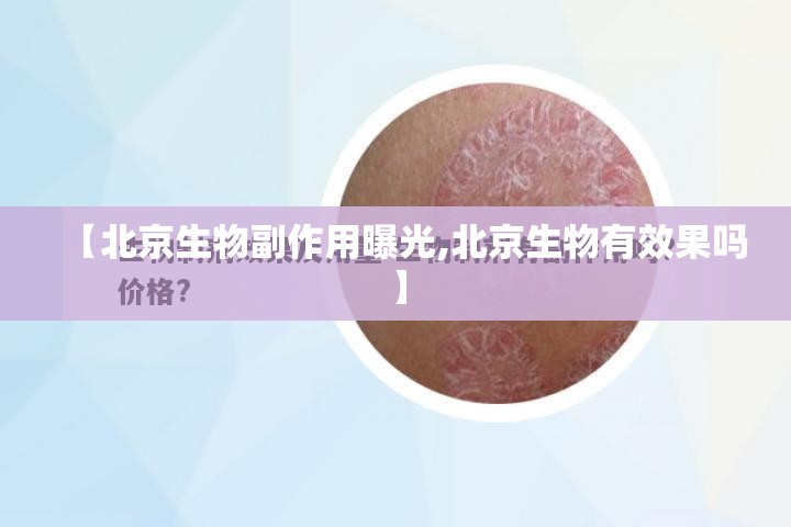 【北京生物副作用曝光,北京生物有效果吗】