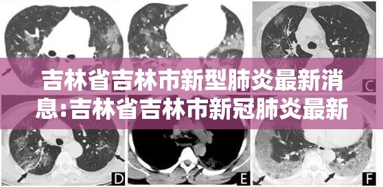 吉林省吉林市新型肺炎最新消息:吉林省吉林市新冠肺炎最新消息