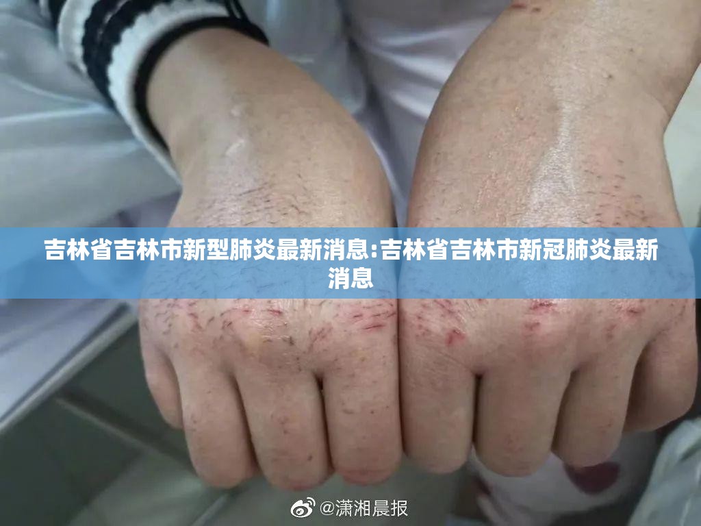吉林省吉林市新型肺炎最新消息:吉林省吉林市新冠肺炎最新消息